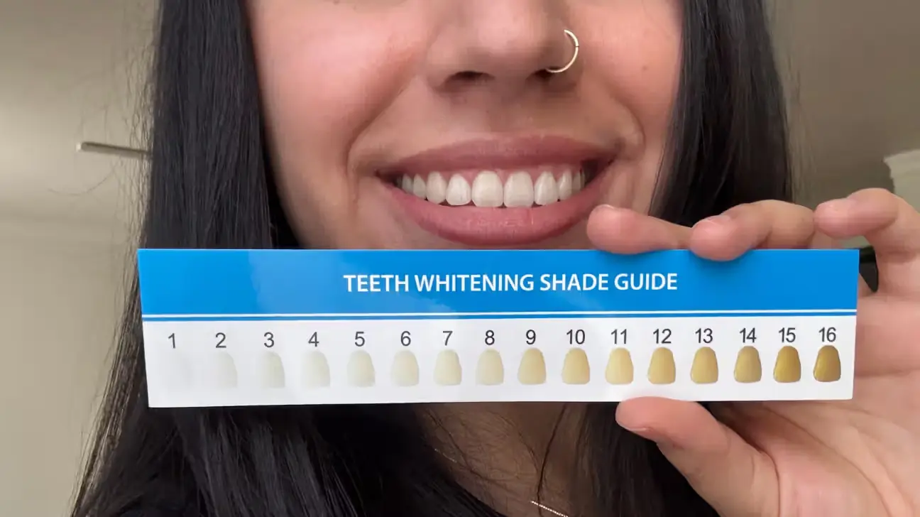 **تبييض الأسنان الكيميائي**: تظهر في ملف "teeth-whitening-test-at-healthline.avif" امرأة تبتسم وتكشف عن أسنانها بوضوح. تمسك المرأة أمام فمها دليلاً لدرجات لون الأسنان (Teeth Whitening Shade Guide) مرقماً من 1 إلى 16. يُستخدم هذا الدليل لمقارنة لون أسنانها الحالي مع التدرجات المختلفة لتقييم مدى استجابتها للتبييض.